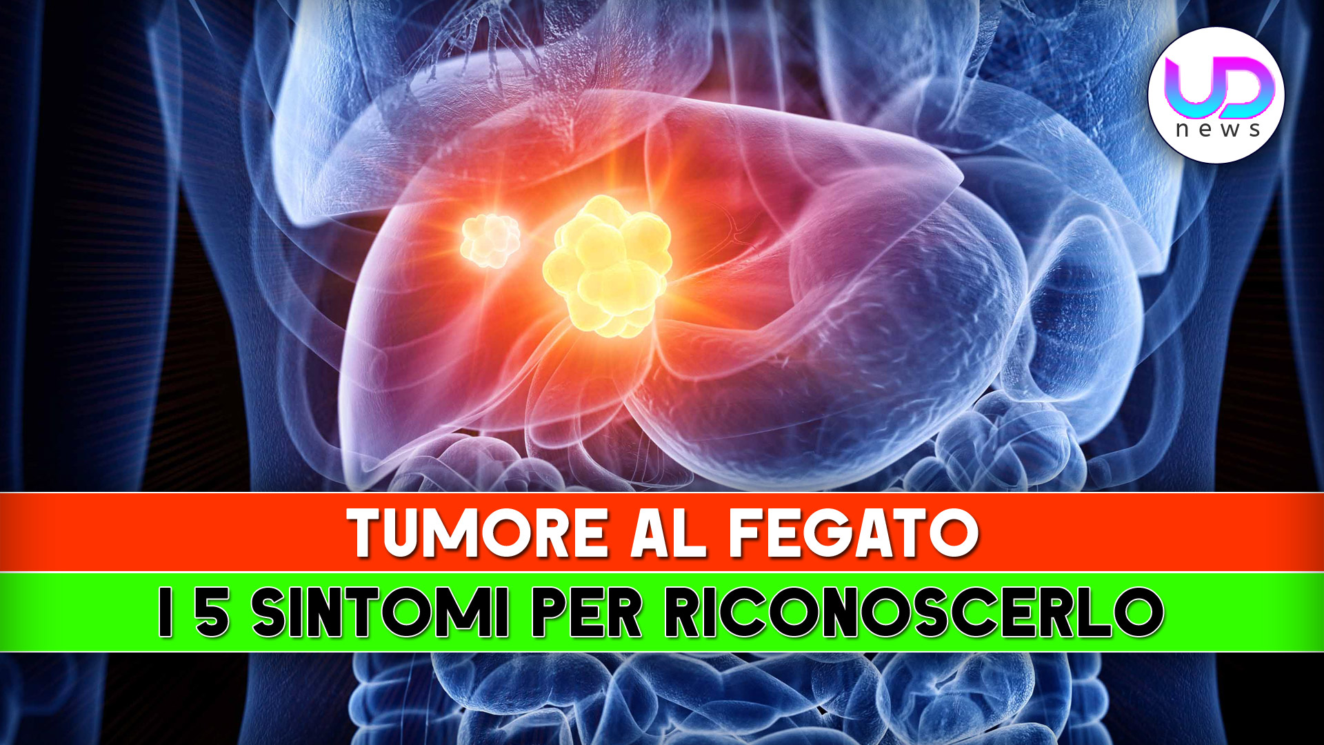 Tumore Al Fegato I Sintomi Per Riconoscerlo Ud News