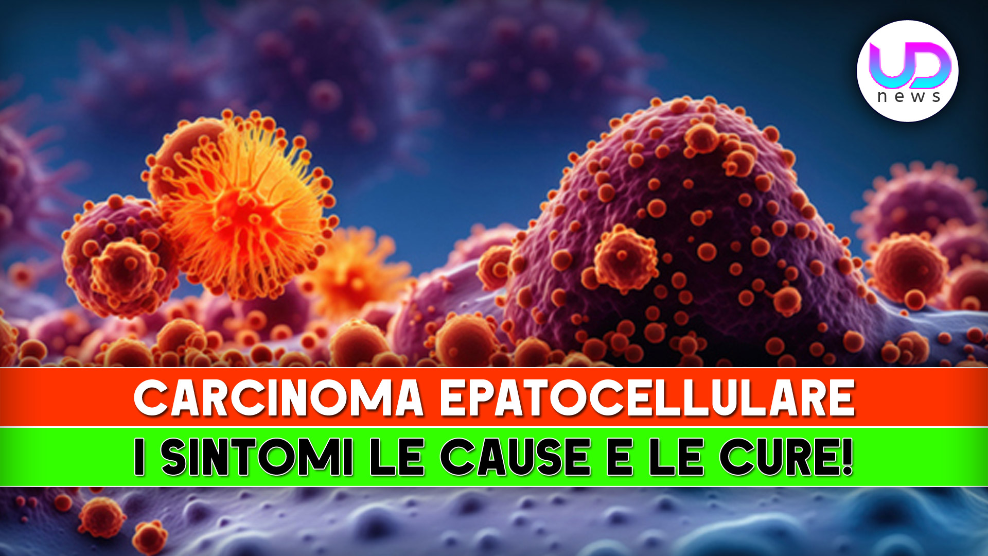 Carcinoma Epatocellulare (HCC): Cause, Sintomi e Cure!